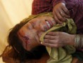 /album/fotogalerie-pro-otrle1/nepal-zranena-jpg/